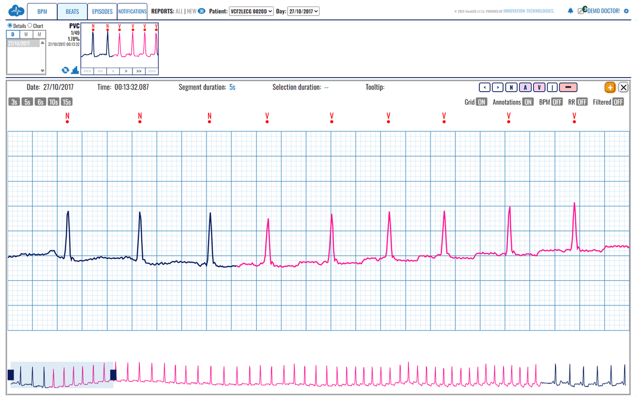 View ECG project thumbnail